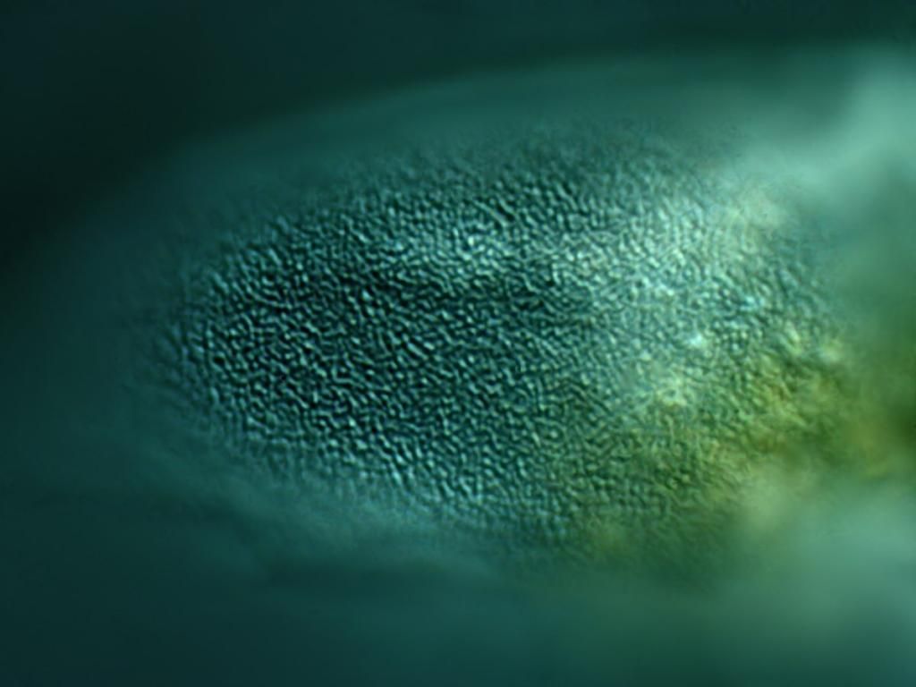 Hyalosphenia_unknown_surface_zpsb161751b.jpg