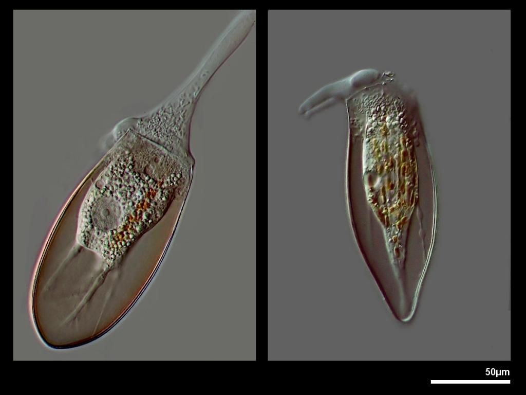 Hyalosphenia_unknown_zpse1dfd04f.jpg